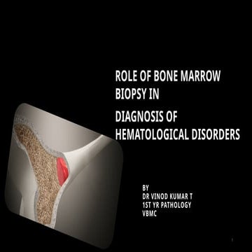 Bone marrow aspiration & trephine biopsy | PPTX