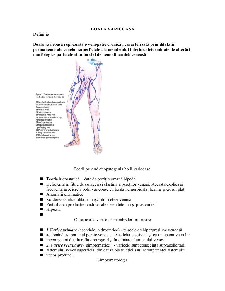 boala varicoasa definitie)