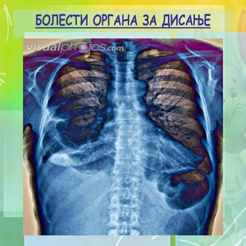 Bolesti organa za disanje | PPT