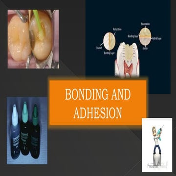 Principles of Adhesion (Operative Dentistry) | PPTX