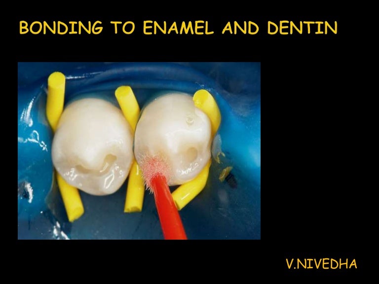 Bonding to enamel and dentin