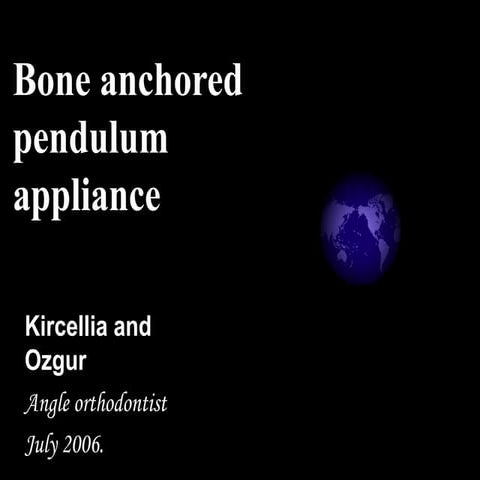 Bone anchored pendulum appliance. (2)