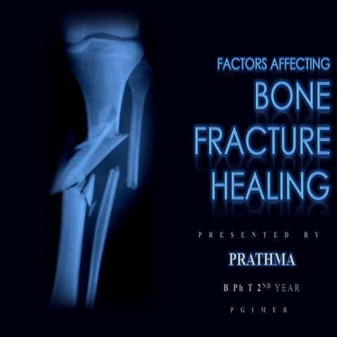 Bonefracture 091120114305-phpapp02