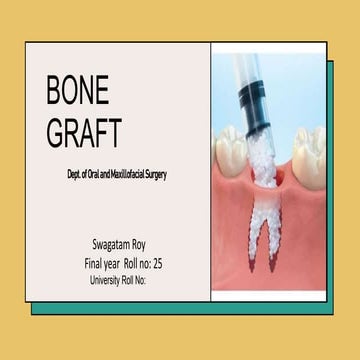 bone graft swagatam by dept of oral and maxillofacial surgery