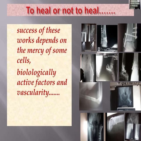 Bone healing.pptx