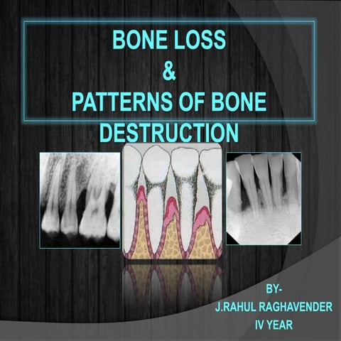 Bone loss and patterns of bone destruction