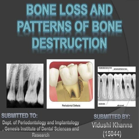 Bone loss and patterns of bone destruction