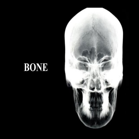 Bones