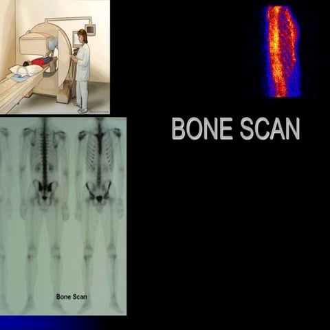 A detailed review of bone scintigraphy using Tc-99m, covering normal ...