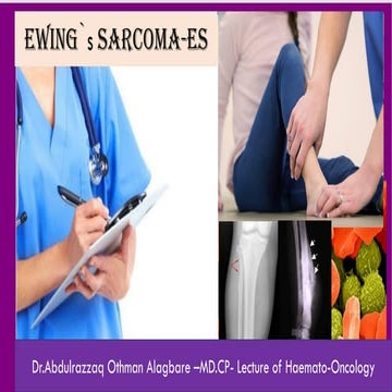 Bones Cancers- Ewing`s Sarcoma.pdf
