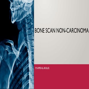 Bone scan in Orthopaedics | PPTX