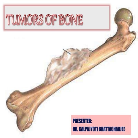 Bone tumors   