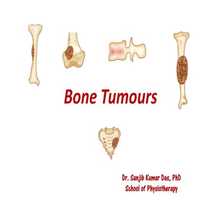 Bone tumours (compiled by Dr. Sanjib Kumar Das)