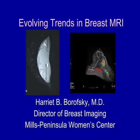 Evolving Trends in Breast MRI