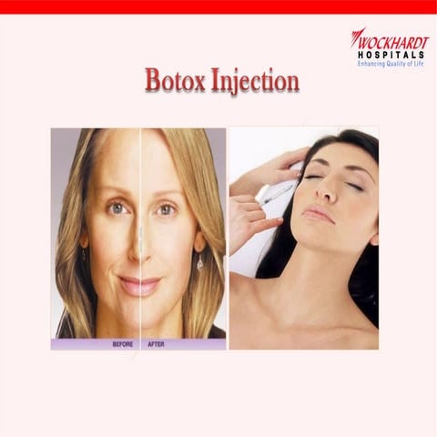 Botox injection