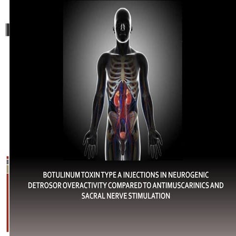 Botulinum toxin type A injections