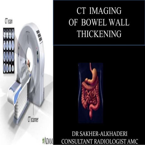 CT Imaging  of Bowel Wall Thickening 