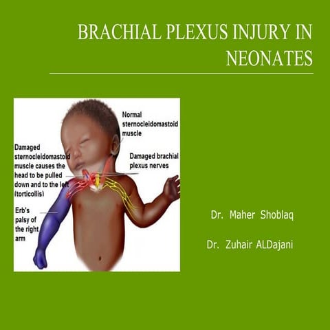 Brachial plexus