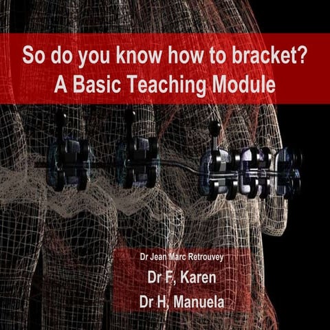 Direct bracketing technique  for dental professionals