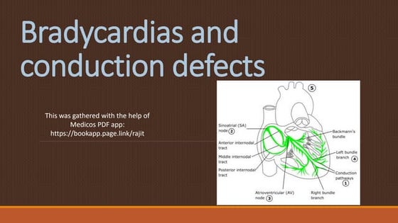 Aterial fibrillation acls | PPT