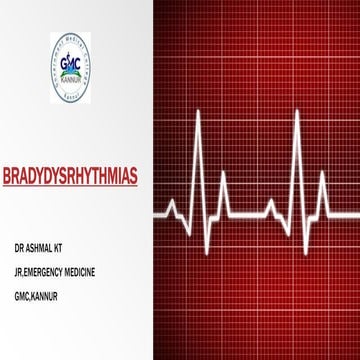 BRADYDYSARRYTHMIAS