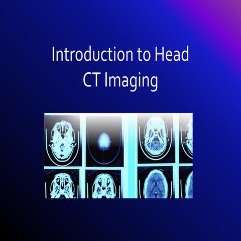 Brain-ct-lecture-new-brain ct imaging.pdf