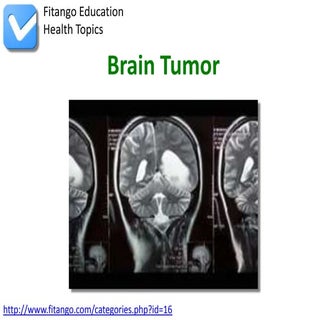 Brain Tumor