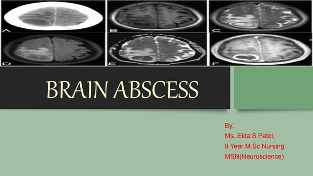 BRAIN ABSCESS.pptx