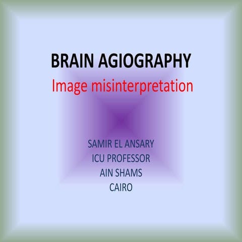 Brain angiography
