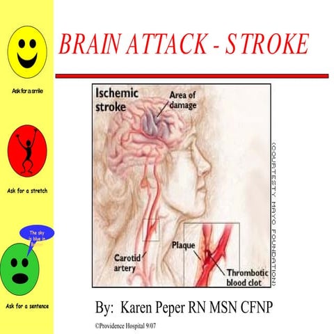Brain Attackdefinitionandidofstrokepresentaiton | PPT