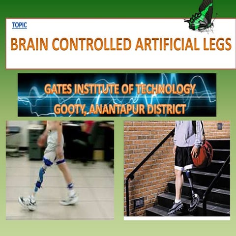 Brain controlled artificial robotic legs
