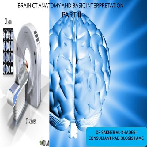 Brain CT Anatomy and Basic Interpretation Part II