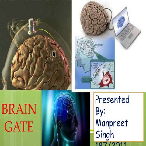 brain gate system