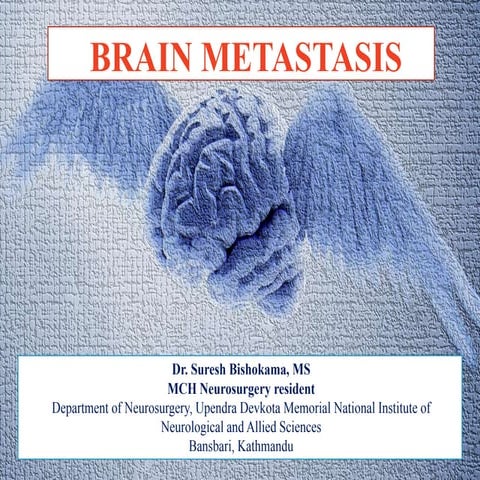 Brain metastasis - Simplified