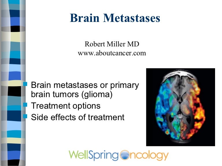 Brain mets video