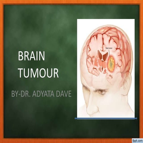 Brain tumor | PPTX