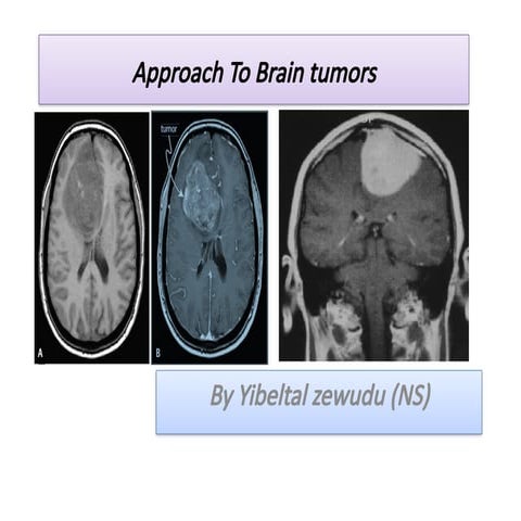 WHO CNS Tumor Classification 2021.pptx