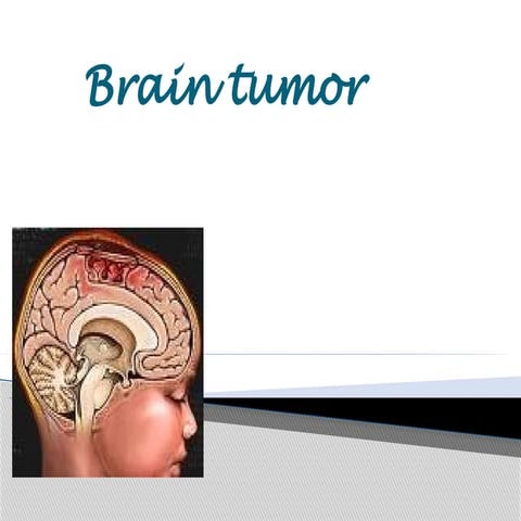 brain tumors and its management adults.pptx
