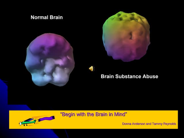 Brain workshopthis one