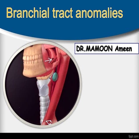 Branchial anomalies 