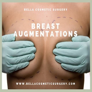 Breast augmentations