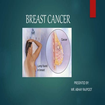 Breast cancer