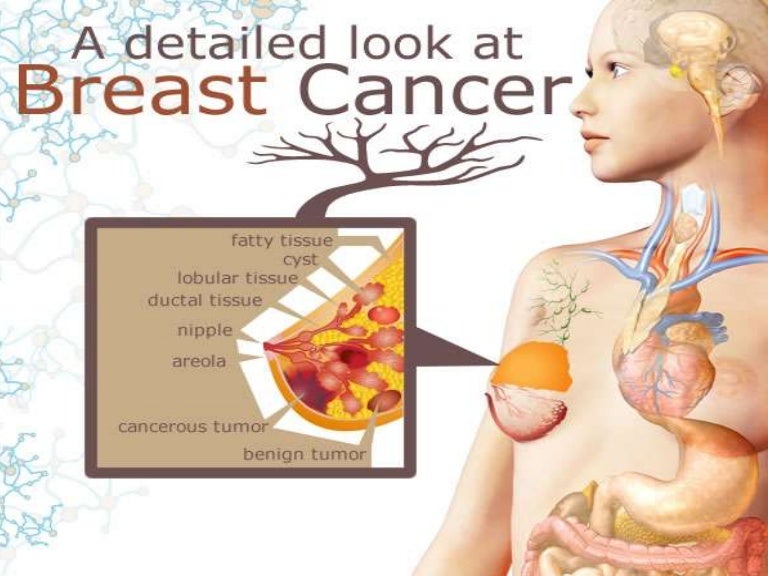 Breast Cancer Awareness Presentation - Learn How To Check ...