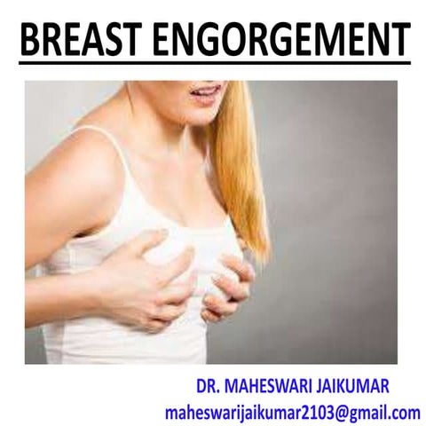 BREAST ENGORGEMENT
