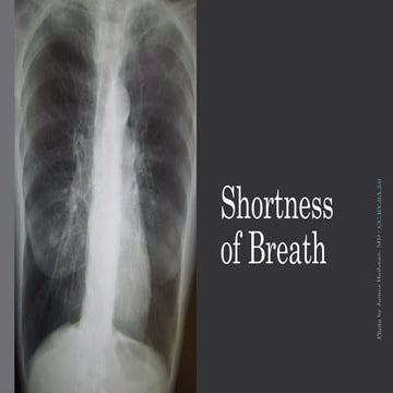 breathlessness-180310190951.pptx nnnnnnnn