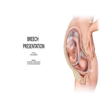 Breech ppt.pptx presentation............