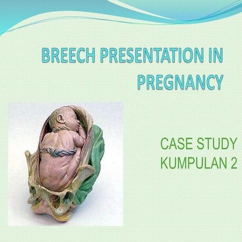Breech presentation in pregnancy 2 