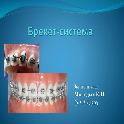 Брекет-система | PPT