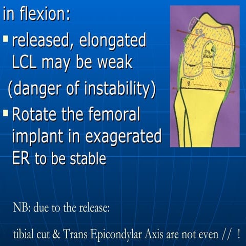 Briard Jl. How To Correct Extra Articular Deformity. Slide 15 26