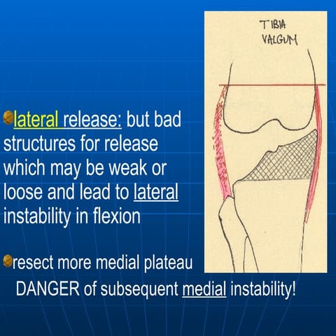 Briard Jl. How To Correct Extra Articular Deformity. Slide 27 40